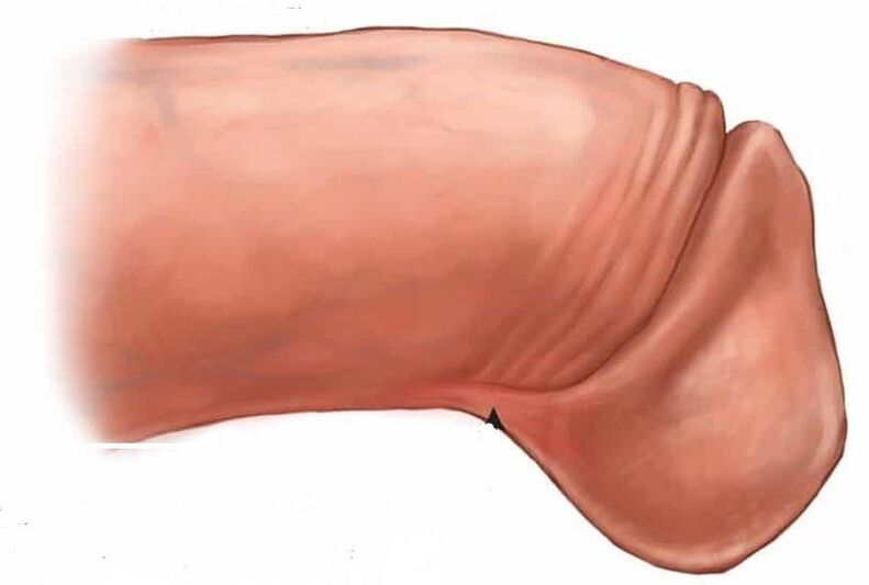 come ingrandire il glande